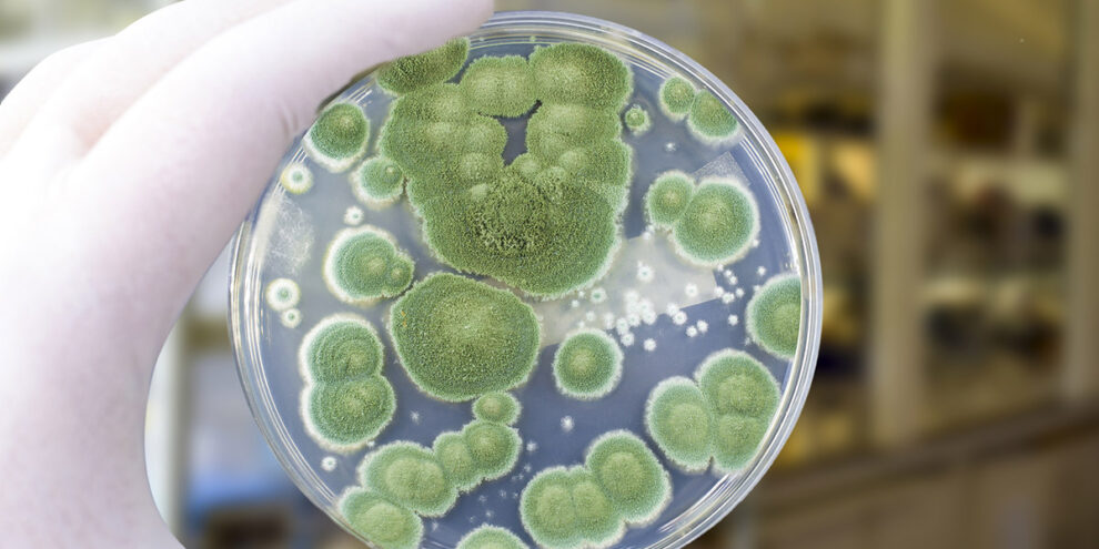 petri-dish-being-held-up-close