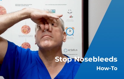 Stop Nosebleeds - How to